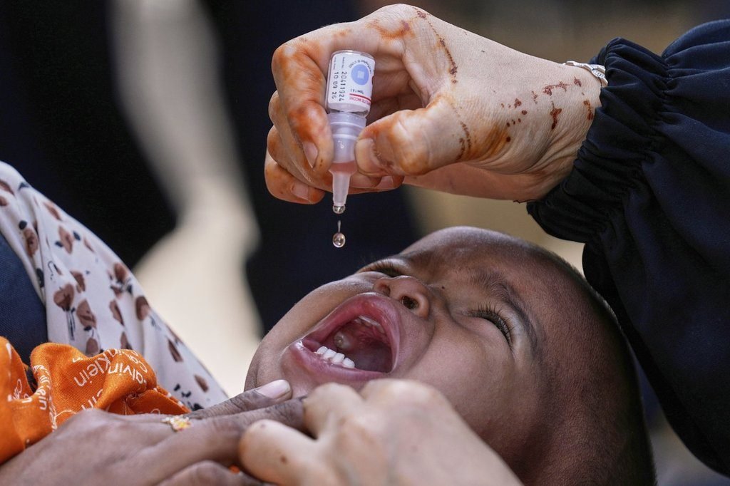 Polio was nearly eradicated. Here’s why it’s making a comeback​Globalnews Digital​