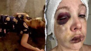 Cincinnati viral beating victim forced into ‘super-secret spot’ with security​​